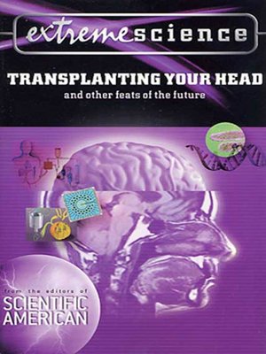 cover image of Transplanting Your Head